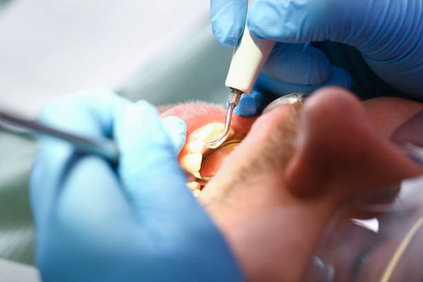 Best Pediatric Emergency Dentist in Tryon, NC