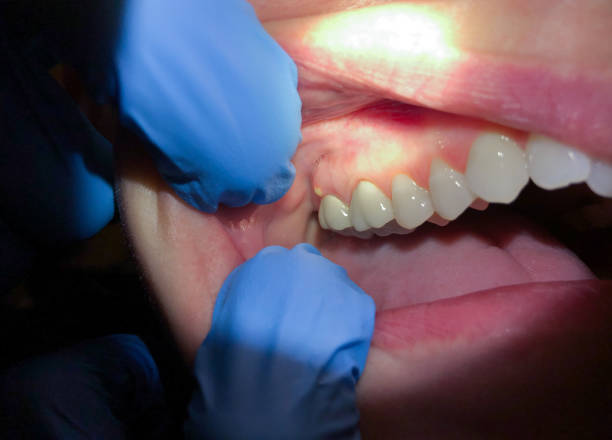 Best Emergency TMJ Treatment in Tryon, NC