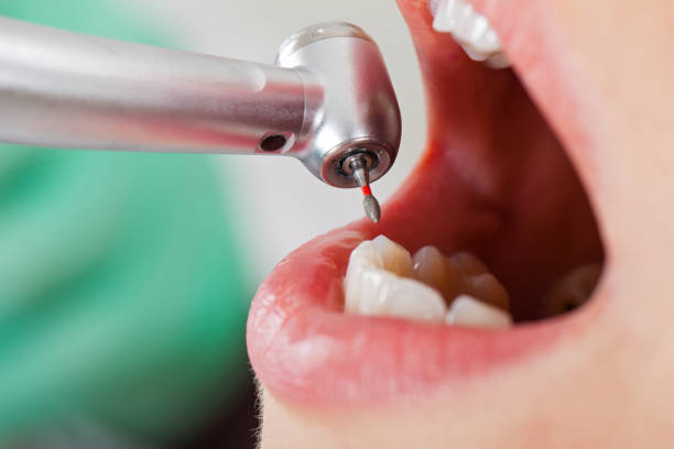 Best Emergency Treatment for Dental Infections or Abscesses in Tryon, NC
